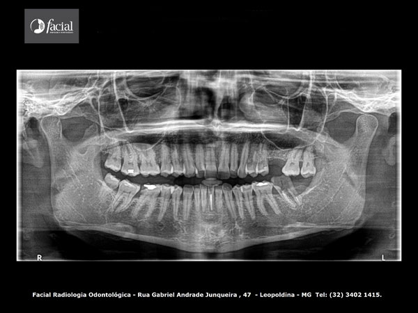 Radiografia Panorâmica 