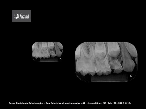 Radiografia Panorâmica