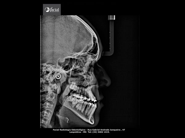 Radiografia Panorâmica